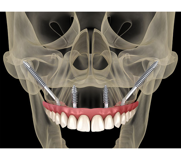 Stamford Oral Surgeon