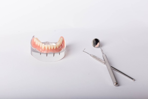 All On  : The Ultimate Solution For Missing Teeth