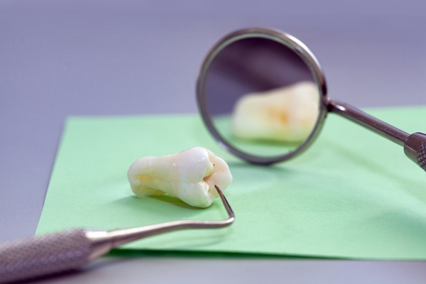 What To Know Before Getting Wisdom Teeth Extractions