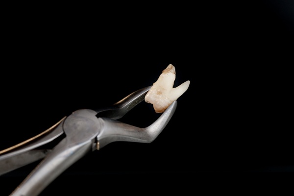 Wisdom Teeth Extractions: When, Why, And What To Expect